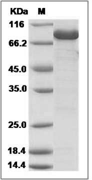 E.coli Lon protease Protein (His Tag) SDS-PAGE