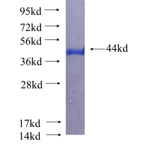 Recombinant human AAMP SDS-PAGE