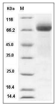 Human ADAM15 Protein (His Tag) SDS-PAGE