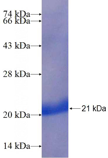 Recombinant Human RPL23 SDS-PAGE