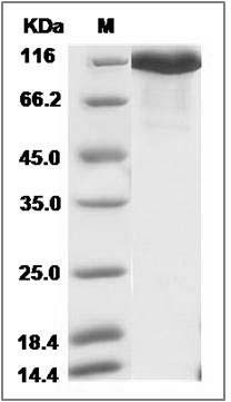 Human NFASC / Neurofascin Protein (His Tag) SDS-PAGE
