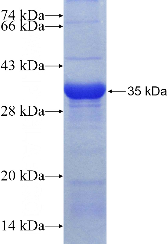 Recombinant Human LPO SDS-PAGE