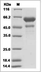 Human VEGF-B / VEGFB Protein (Fc Tag)