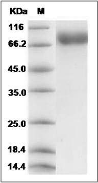 Rat KIT / c-KIT Protein (His Tag) SDS-PAGE