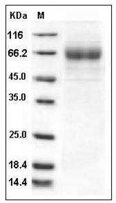 Influenza A H3N2 (A/Wisconsin/67/X-161/2005) Hemagglutinin Protein (HA1 Subunit) (His Tag) SDS-PAGE