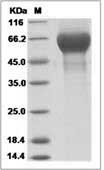 Influenza A H3N2 (A/Sydney/5/1997) Hemagglutinin / HA1 Protein (His Tag)