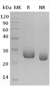 Human PRADC1/C2orf7/PAP21/UNQ833/PRO1760 (His tag) recombinant protein