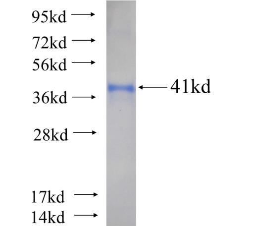 Recombinant human SRP14 SDS-PAGE