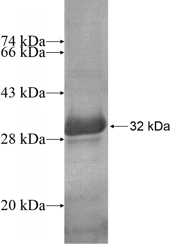Recombinant Human ESRP1 SDS-PAGE