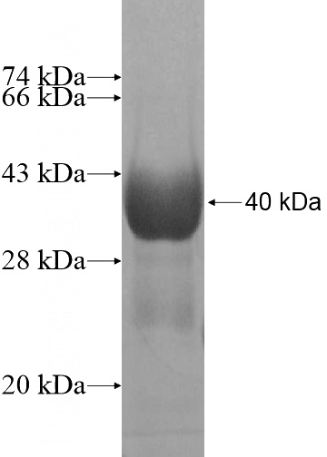 Recombinant Human DNAJC11 SDS-PAGE