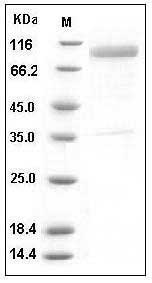 Human IL13RA2 / IL13R Protein (His & Fc Tag) SDS-PAGE