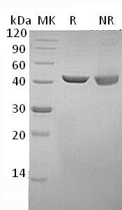 Human SEPHS1/SELD/SPS/SPS1 (His tag) recombinant protein