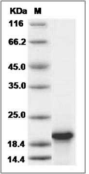 Human Troponin C / TNNC1 Protein SDS-PAGE