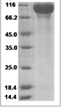 Cynomolgus EGFR/HER1 Protein 14108