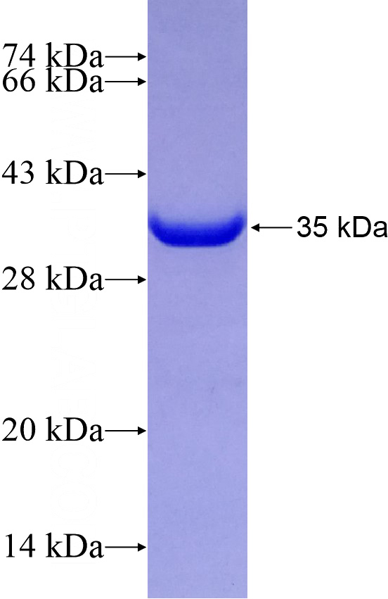 Recombinant Human PLK4 SDS-PAGE