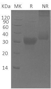 Human CGB5 (His tag) recombinant protein
