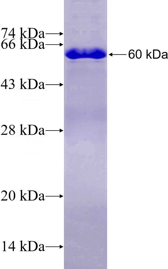 Recombinant Human FBLN5 SDS-PAGE