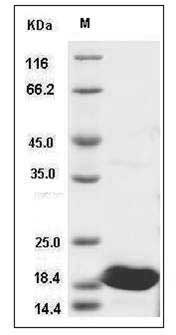 Human IL37 / IL1F7 / IL-1H4 Protein SDS-PAGE