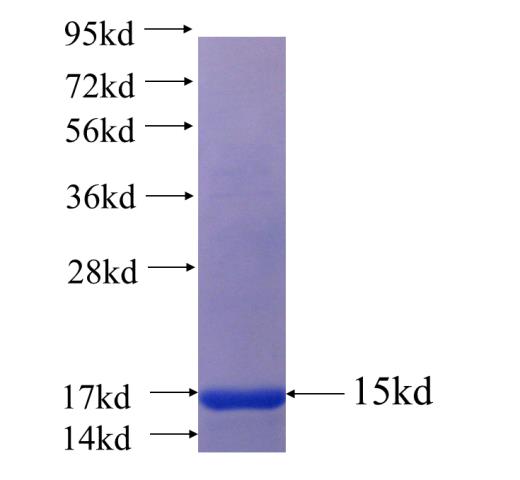 Recombinant human DIO3 SDS-PAGE