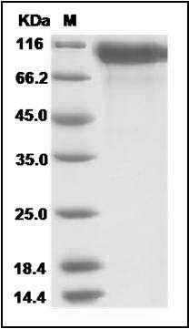 Human HER2 / ErbB2 Protein (His Tag) SDS-PAGE