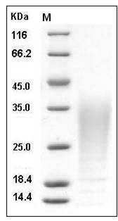 Cynomolgus IL13 / ALRH Protein (His Tag) SDS-PAGE