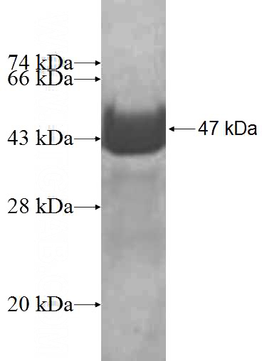 Recombinant Human CRYGS SDS-PAGE