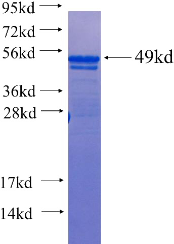 Recombinant Human SGK2 SDS-PAGE