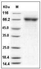Influenza A H5N1 (A/chicken/India/NIV33487/2006) Hemagglutinin / HA Protein (His Tag) SDS-PAGE
