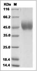 Ebola virus EBOV (subtype Zaire, strain Mayinga 1976) GP-RBD / Glycoprotein Protein (His Tag)