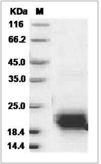 Rat VEGFC / VEGF-C Protein (aa 108-223, His Tag) SDS-PAGE