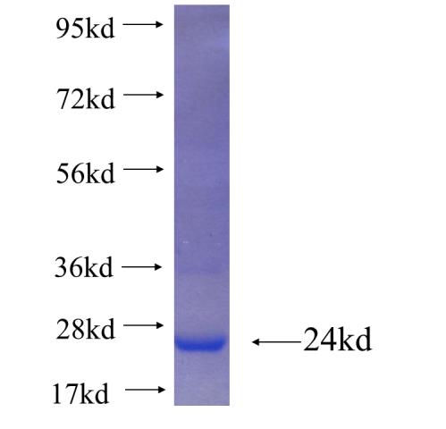Recombinant human SPEF1 SDS-PAGE
