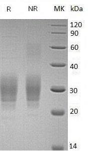 Human VSTM1/UNQ3033/PRO9835 (His tag) recombinant protein