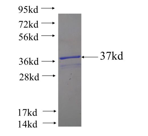 Recombinant human WIPI1 SDS-PAGE