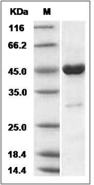 Human SRI / Sorcin Protein (His & GST Tag) SDS-PAGE