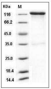 Rhesus HER2 / ErbB2 Protein (Fc Tag) SDS-PAGE