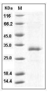 Mouse MBL1 Protein (His Tag) SDS-PAGE