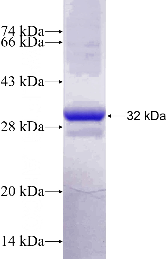 Recombinant Human TYK2 SDS-PAGE