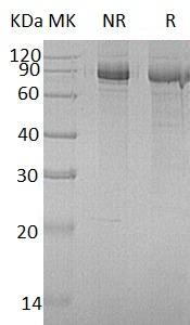 Human INPP1 (His tag) recombinant protein