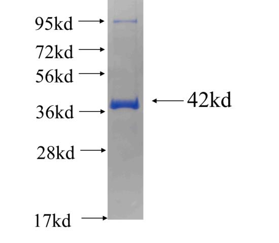 Recombinant human TOM20 SDS-PAGE