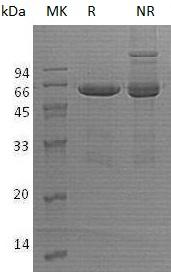 Human OGG1/MMH/MUTM/OGH1 (GST tag) recombinant protein