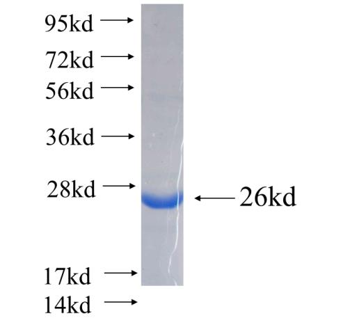 Recombinant human CCDC115(Full length) SDS-PAGE