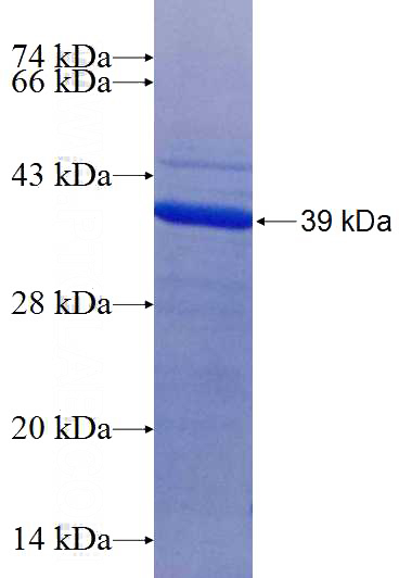 Recombinant Human EEFSEC SDS-PAGE