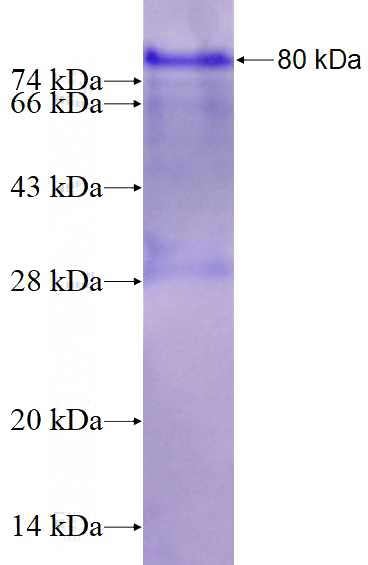 Recombinant Human MADCAM1 SDS-PAGE