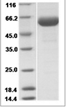 Human FCGR1 recombinant protein (C-His)