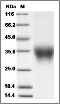 Cynomolgus ACVR2B / ACTRIIB Protein (His Tag) SDS-PAGE