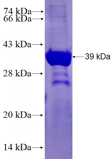 Recombinant Human PCSK2 SDS-PAGE