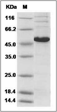 Human PRKAR1A / PRKAR1 / PKR1 Protein (His Tag) SDS-PAGE