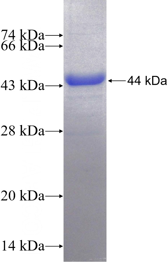 Recombinant Human UBAC1 SDS-PAGE