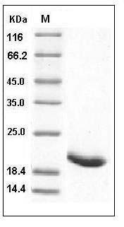 Human IL-1RA / IL1RN Protein SDS-PAGE