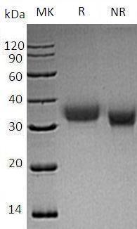 Human PRDX4 (His tag) recombinant protein